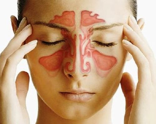 Allergic rhinitis in a child and an adult - how to get rid of it